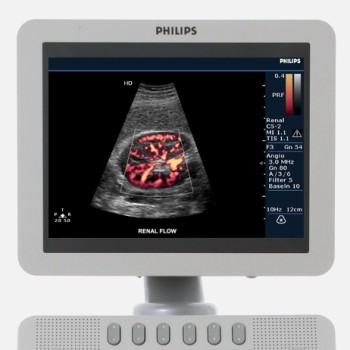 PHILIPS HD 6 | MEDtechnic services s.r.o.