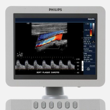 PHILIPS HD 6 | MEDtechnic services s.r.o.