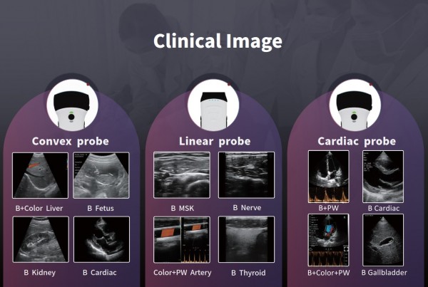 Kapesní ultrazvuk C10TX Pro