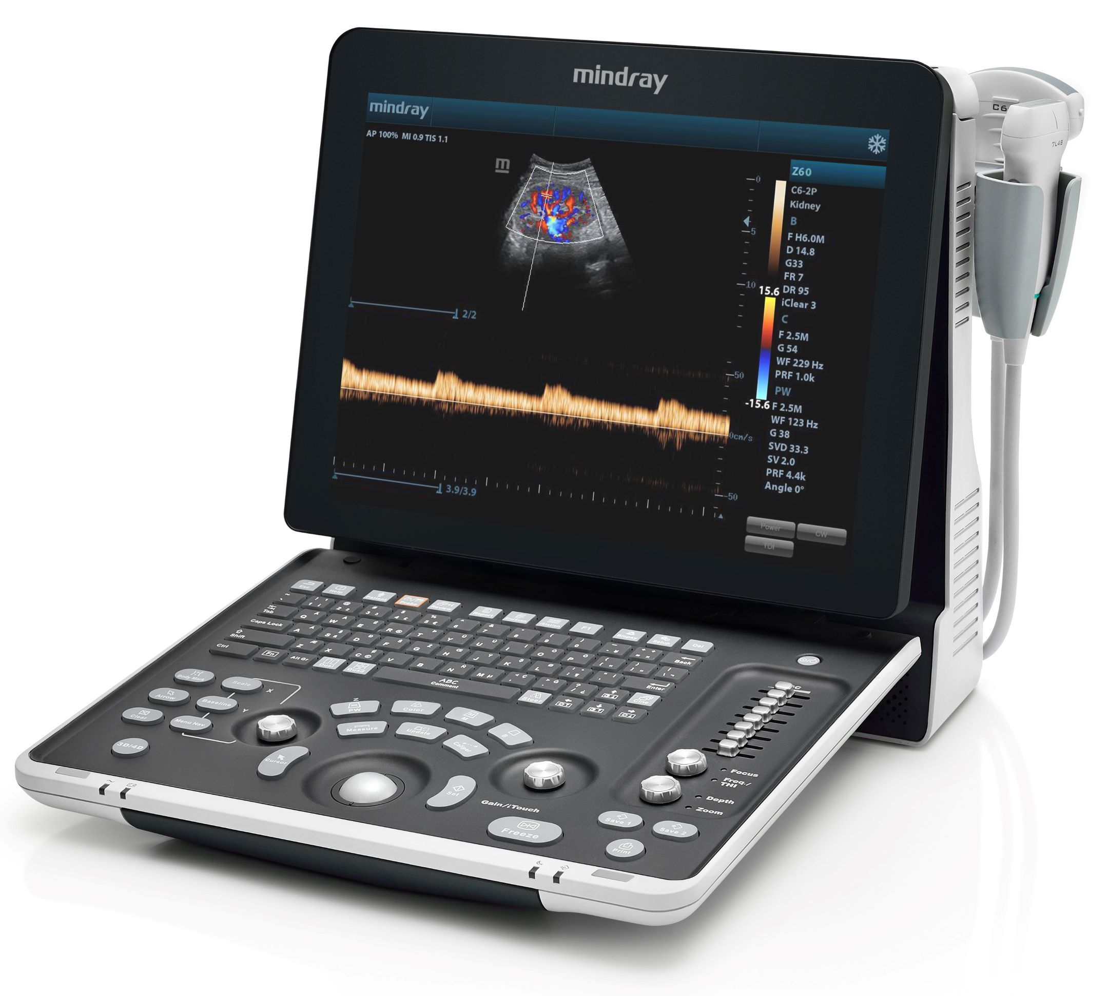 MINDRAY Z60 MEDtechnic services s.r.o.